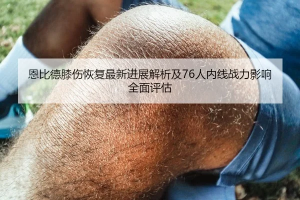恩比德膝伤恢复最新进展解析及76人内线战力影响全面评估